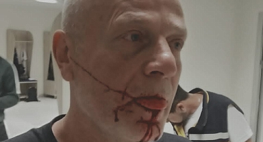 YOMRASPOR 'A SALDIRI: BU NE BARBARLIK!