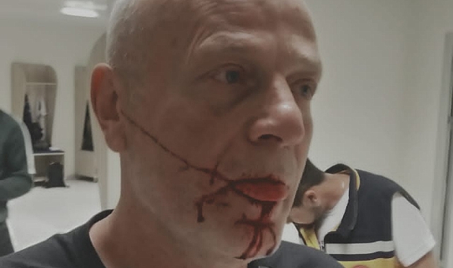 YOMRASPOR 'A SALDIRI: BU NE BARBARLIK!