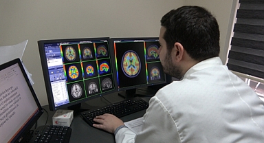 KANUNİ EĞİTİM VE ARAŞTIRMA HASTANESİ'NDEN ALZHEİMER HASTALARINDA YENİ TANI YÖNTEMİ