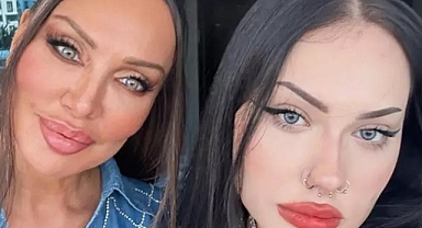 SANATÇI UMUT AKYÜREK'İN ZOR GÜNLERİ