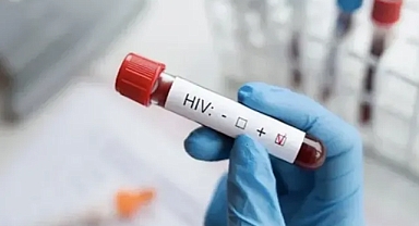 13 YAŞINDAKİ ÇOCUK AİDS'TEN ÖLMÜŞ