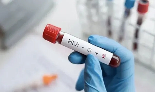 13 YAŞINDAKİ ÇOCUK AİDS'TEN ÖLMÜŞ