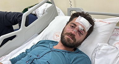 HEYELAN UYKUDA YAKALADI