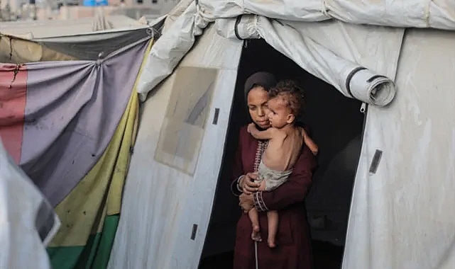 GAZZE AÇLIKTAN ÖLÜYOR! BU GÖRÜNTÜLERE YÜREK DAYANMAZ