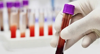 A RH+ GRUBU OLANLAR DİKKAT! 